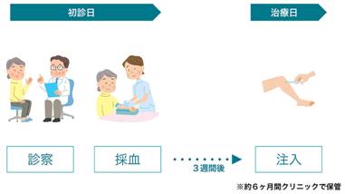 PRP-FD(PFC-FD)治療の流れ